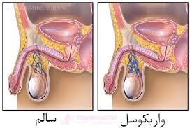 معجون واریکوسل وارداتی/طب سنتی هندی ایرانی با ده گرم ژل رویال